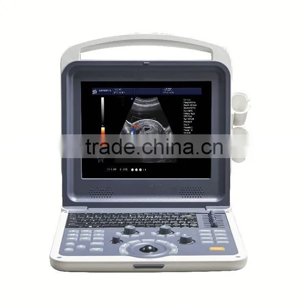 Cheapest 4d Color Doppler Ultrasound From China With Low Price