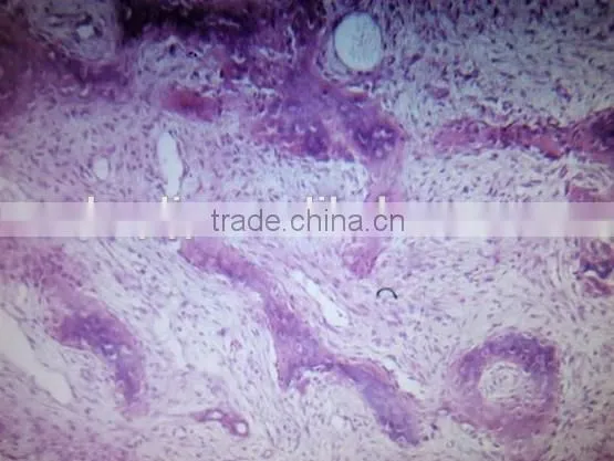 Fibrous hyperplasia of bone sec. oral histology pathology parasitology prepared slides