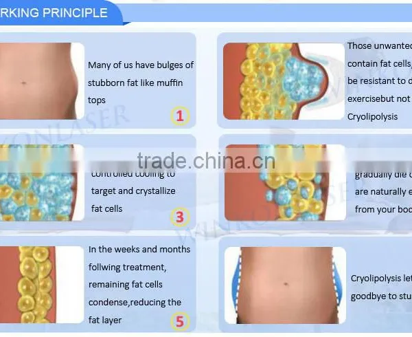 Price Cryolipolysis / Cryolipolysie Weight Loss / Cryolipolysis Body Slimming Machine Fat Melting photo-6