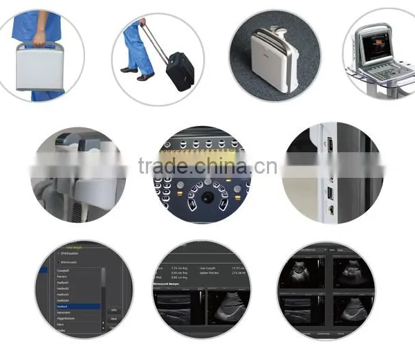 Medical Veterinary Equipment Trolley Color Doppler Ultrasound Machine System photo-2