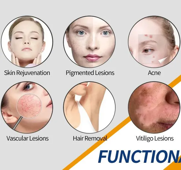 ADM Portable DPL Laser Remover Hair Intense Pulsed Light Permanent Hair Removal Laser Dpl Skin Rejuvenation Machine photo-5