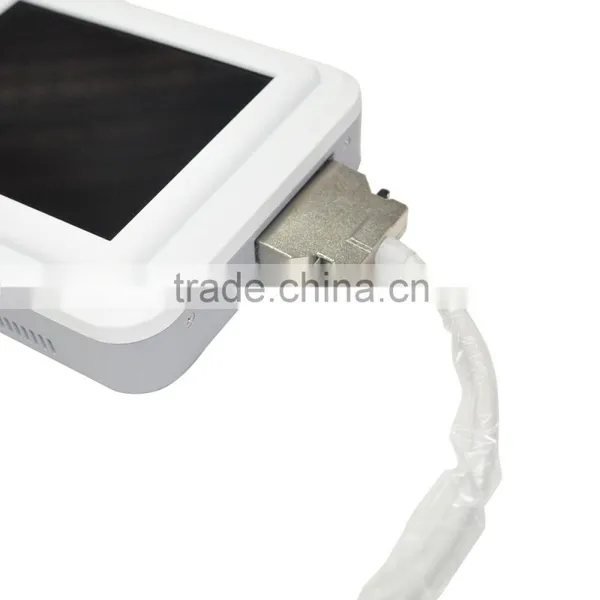 2015 New Design Handheld Ultrasoud Scanner RUS-8000A 3.5MHz Convex Array Probe photo-4