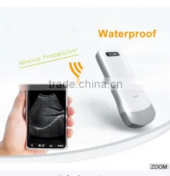 SIFHEALTH-6.1 Wireless Probe Ultrasound Scanner/Healthcare Supply photo-2