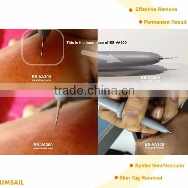 Painless High Frequency Facial Vascular Lesion Removal Beauty Machine photo-2