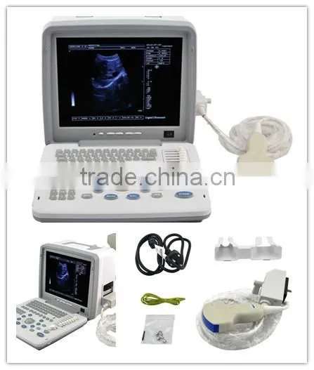 Good Price Full Digital Portable Ultrasound Scanner RUS-6000D With Linear Transvaginal Convex Microconvex Probe photo-2