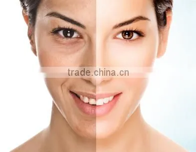 IPL Beauty Machine to Get Face Rejuvenation With Hair Removal Function photo-3