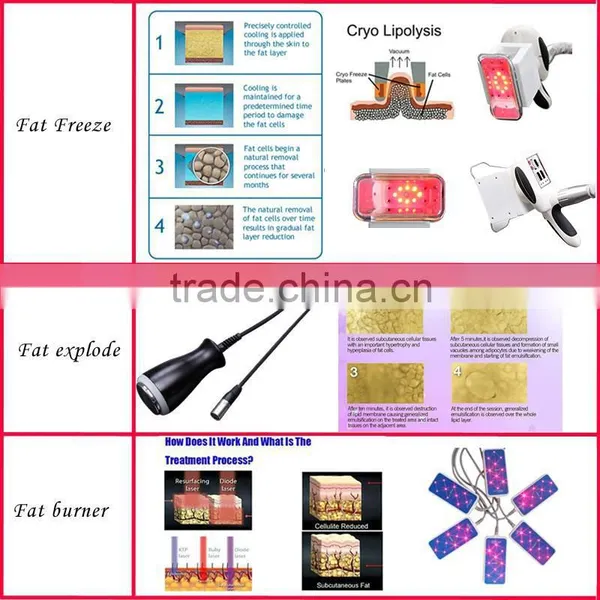 Multifunctional Vacuum Rollerslimming Machine Kriolipoliza Liposukce Fat Removal Maquina photo-6