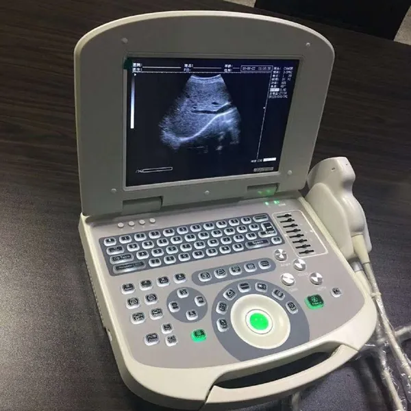 All Digital Ultrasonic Diagnosis SystemPortable Digital Acoustic Diagnostic Scanner for Human in Hospital photo-2