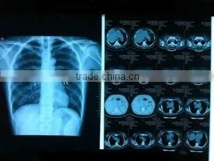 Agfa Film Agfa Dry Films Agfa X-ray Film photo-3