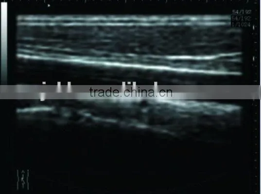 Notebook Ultrasound Scanner RUS-9000F With 3.5Mhz Convex Probe and 7.5Mhz Linear Probe Diagnosis Machine photo-3