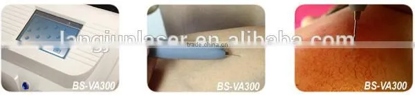 Beauty Therapy System HF or RF Vascular Vein Removal Treatment Device photo-3