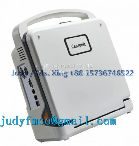 Portable Color Doppler Ultrasound Scanner System photo-4