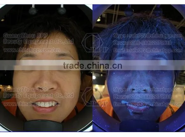 RGB and UV Spectrum Skin Analysis Camera for Analysis Skin Characteristic photo-6