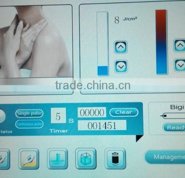 Laser Ipl Elight/ipl Machine/freckle Removal , Laser Ipl Beauty Machine photo-6