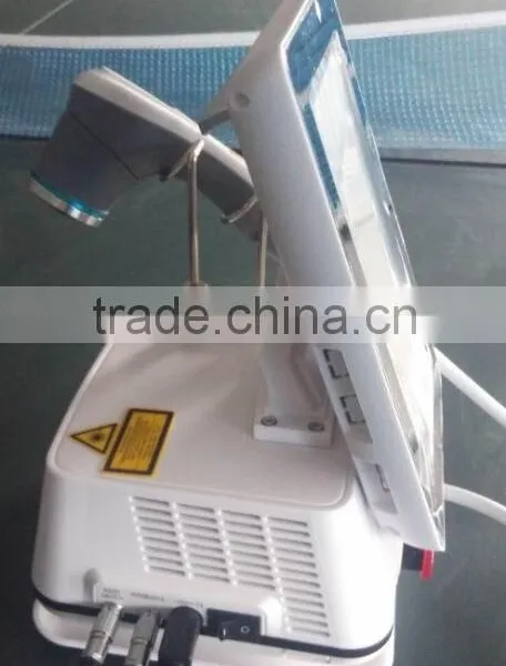 Spider Vein Removal Laser photo-2