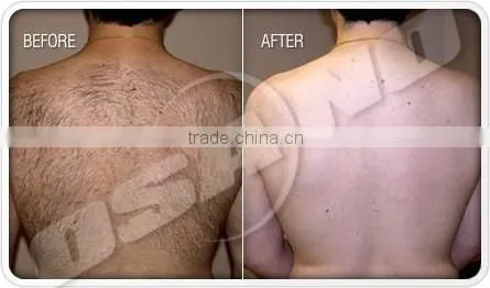 Arms / Legs Hair Removal SHR Portable Ipl Hair Removal Machine Bikini Hair Removal photo-4