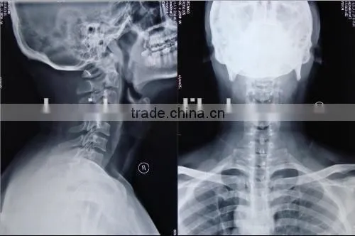 Medical Dry Films,medical Films.fuji Dry Film