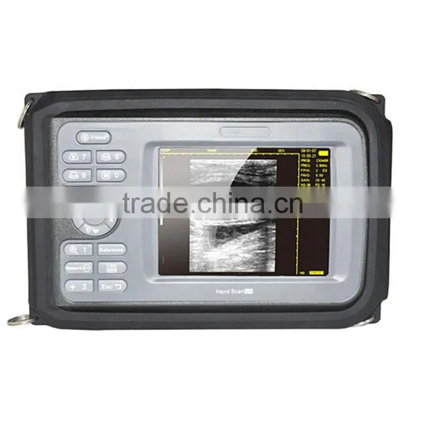 Handheld Touch Ultrasonic & Ultrasound Scanner Mini Ultrasound Machine for Sale photo-2