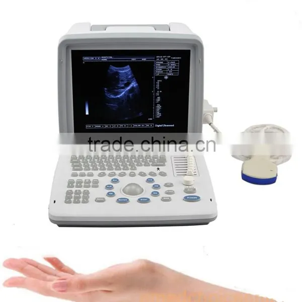 OEM Supply 12 Inch Laptop Ultrasound Scanner Ultrasonic Machine B Ultrasound Scanner for Sale photo-2