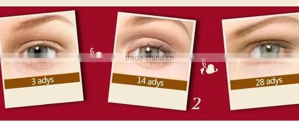 Portable Korea Hifu Beauty Eye Care Skin Whitening High Quality Low Price photo-5