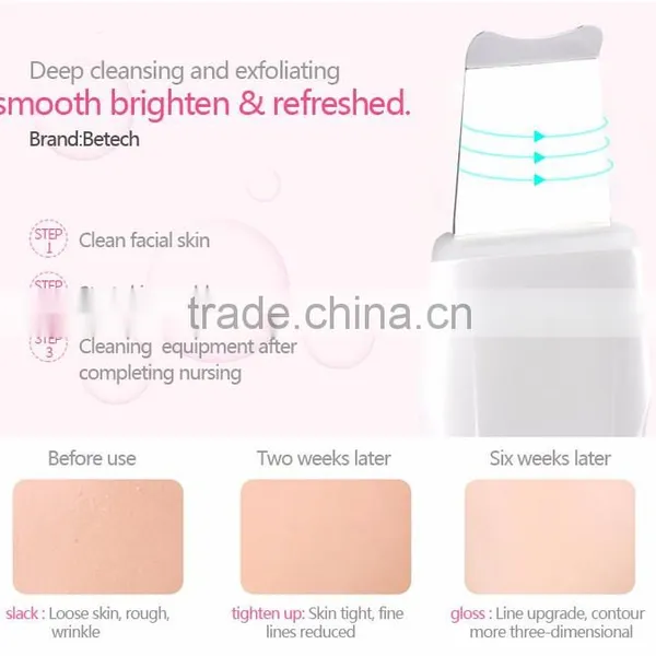 Ultrasonic Facial Skin Scrubber Beauty Instrument photo-2