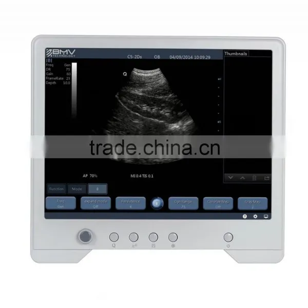 B&W Touch Screen Ultrasound Scanner/machine TS20 photo-4