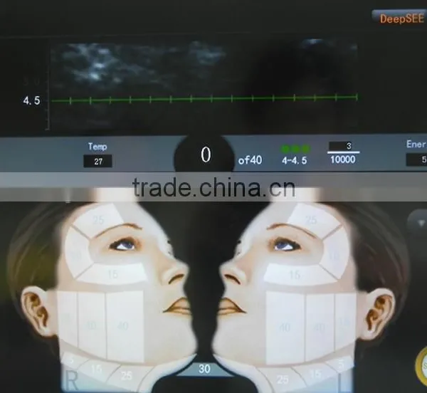 30000 Times High Intensity Focused Ultrasound HIFU Equipment photo-2