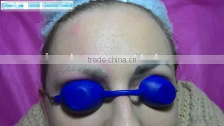 Tattoo Pigment Removal Beauty Machine photo-2