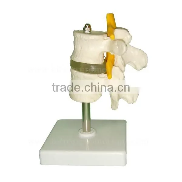 Human Body Anatomy Spine Model Lumbar Vertebra photo-4
