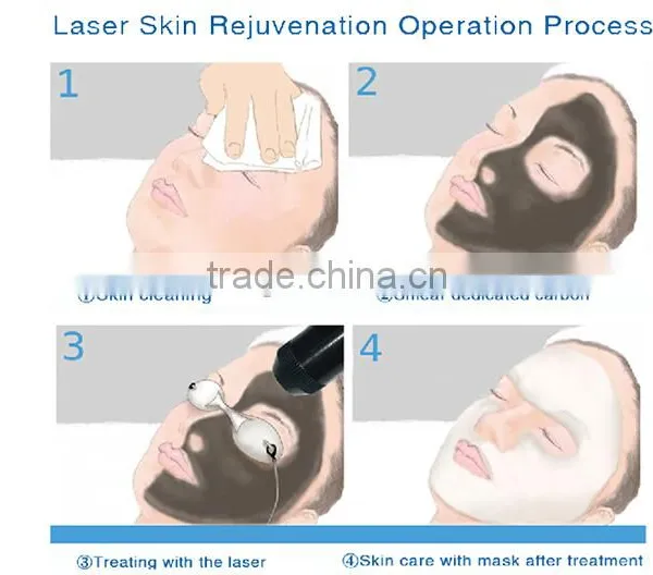 Easy Operation Laser Acne Removal Machine photo-6