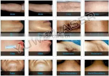 10.4 Inch Screen Amazing New Arrival Most Advanced 808nm Diode Laser 1-10HZ High Power /diode Laser Hair Removal Machine / Diode Laser 808 8.4 Inches photo-6