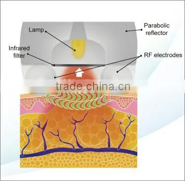 6 in 1 Lipo Ultrasonic Cavitation Machine , RF 940nm Vacuum rf Device photo-5