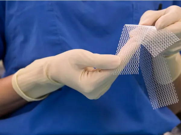 Surgical Polypropylene Mesh for Hernia Repair