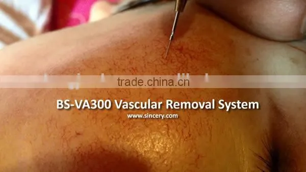 HF Spider Veins Removal Machine For Small Vessels Vascular Veins on Face, Ear Back, Forehea photo-4