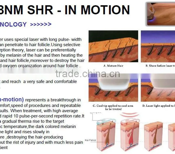 Pain-Free Portable 808nm Diode Arm / Chest Hair Removal Laser Hair Removal photo-4