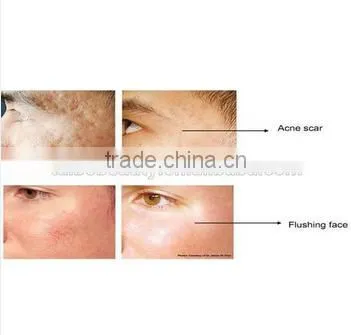 rf Lifting Radio Frequency Skin Tightening Machine Beauty Salon Spa Clinic Equipment photo-6