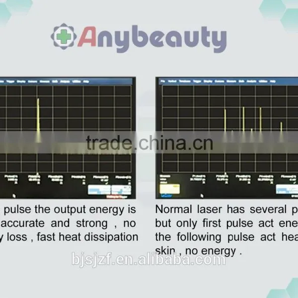 Anybeauty Hot Sale 532nm&1064nm for All Tattoo Removal Beauty Machine photo-3