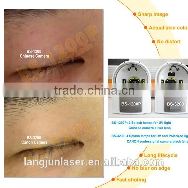 RGB/PL/UV Tri-spectrum Facial Skin Analyzer Portable photo-4