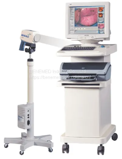 Medical Equipment Digital Video Colposcope for Gynecology