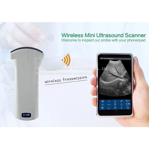192 Element Handheld Wireless Pocket Ultrasound Scanner Probe Convex Linear photo-4