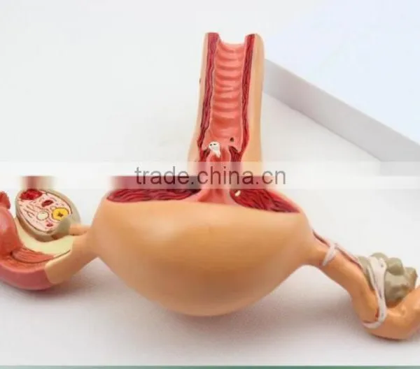 Human Uterus and Ovary Vaginal Pathological Changes Model of Reproductive Department of Gynecology Medical Demonstration Model photo-2