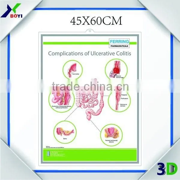 Custom Printed 3D Medical Wall Chart / Pregnancy Chart photo-5