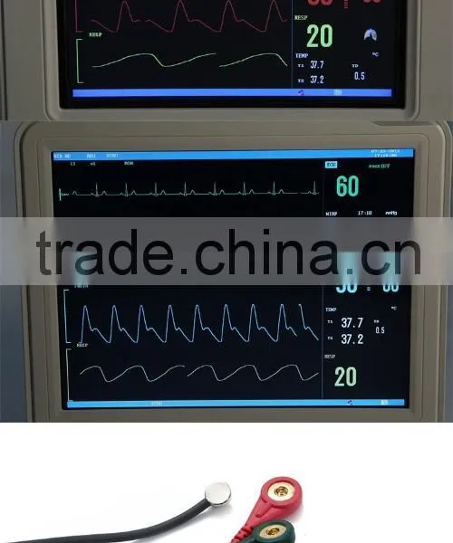 Economic Price New Medical Device 8-inch Portable Multiparameter Patient Monitor for Hospital photo-6