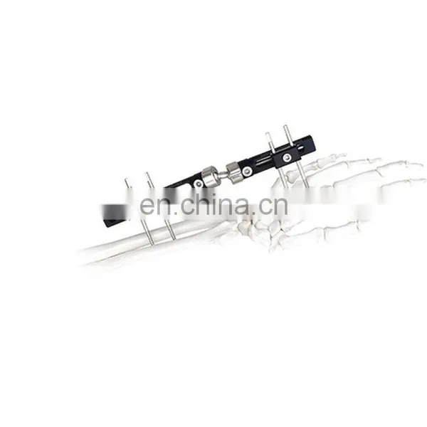 High Quality Wrist Joint External Fixator Orthopedic Surgical Instrument photo-6
