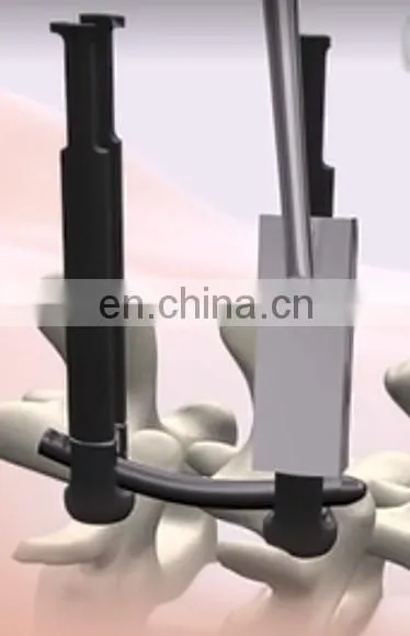 Spine Retractors, Neurosurgery Instruments, Spinal Surgery Distractor photo-7