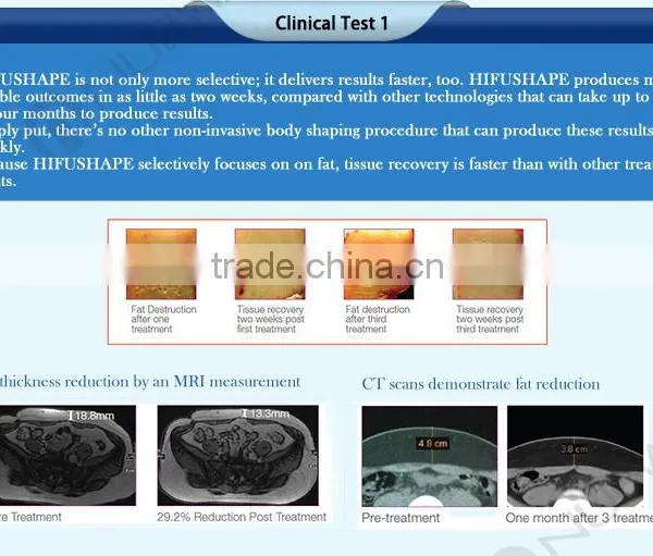 CE / FDA Approved High Effective HIFU Shape Body Slimming Machine Far Infrared Slimming Pressotherapy Machine photo-2