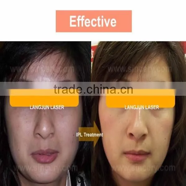 Best Choose Beauty Salon Equipment Ipl 8.4 Inches Diode Laser Hair Removal Machine Price Female photo-4