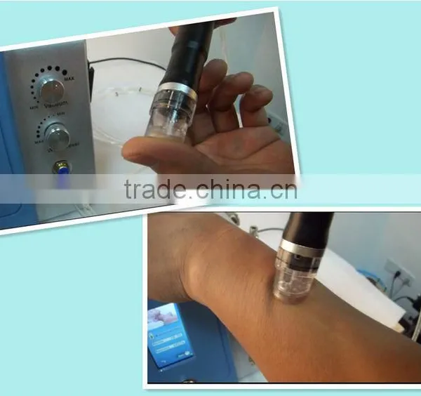 NL-SPA900---Hot Sale Water Dermabrasion &diamond Dermabrasion &micodermabrasion With CE photo-5