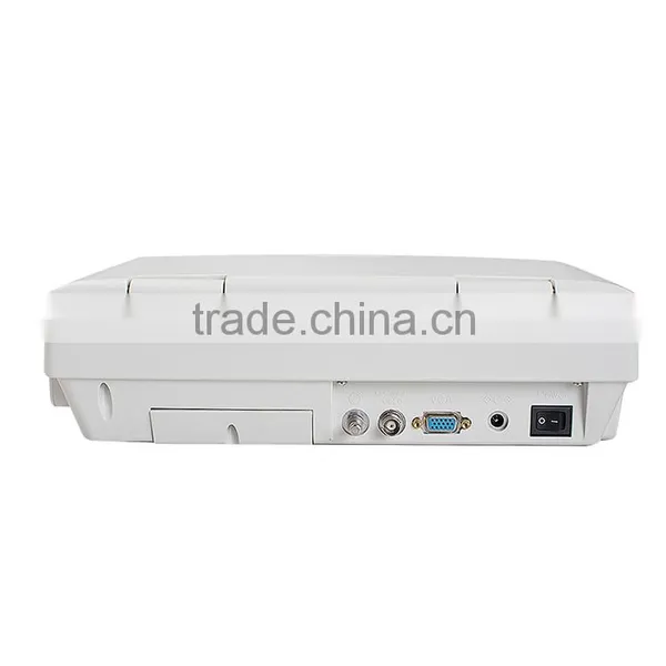 China Medical Human Use Ultrasound Scanner Portable Laptop photo-5