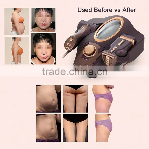 Factoty Wholesale Face Skin Tightening Machine Multifunction Slimming Machine photo-4